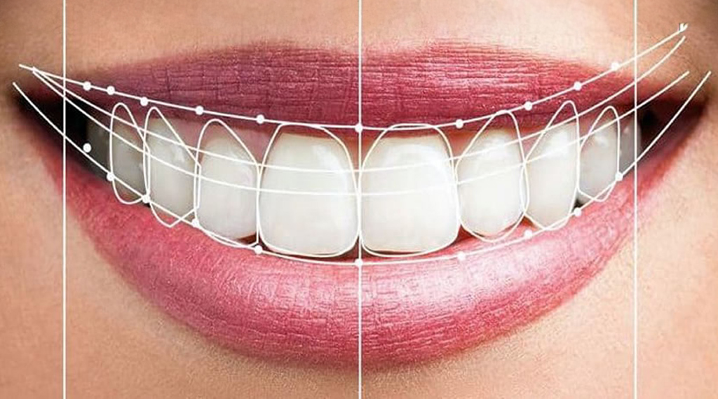 Estética Dental